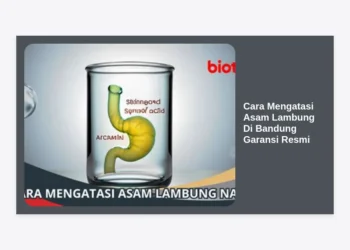 10+ Cara Mengatasi Asam Lambung Di Bandung Garansi Resmi: Solusi Permanen Bebas Perih