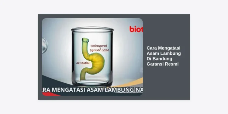 10+ Cara Mengatasi Asam Lambung Di Bandung Garansi Resmi: Solusi Permanen Bebas Perih