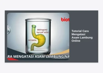 Tutorial Cara Mengatasi Asam Lambung Online: Panduan Lengkap Medis & Alami