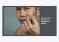 Skincare Pria Berjerawat Terdekat Di Medan: Panduan Lengkap & Rekomendasi Klinik Terbaik